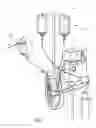 Fig. 02 - Catheter pump with off-set motor position