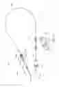 Fig. 05 - Catheter pump with off-set motor position