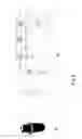 Fig. 09 - Drug delivery system and method for controlled and continuous delivery of drugs into the brain by bypassing the blood brain barrier