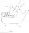 Fig. 02 - Guiding device for dental anesthesia