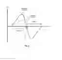 Fig. 03 - Methods and apparatus with improved ventilatory support cycling