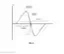 Fig. 06 - Methods and apparatus with improved ventilatory support cycling