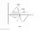 Fig. 08 - Methods and apparatus with improved ventilatory support cycling