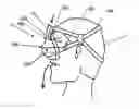 Fig. 01 - Breathing assistance apparatus
