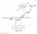 Fig. 08 - POSITIONING DEVICE AND METHOD FOR USE WITH A PATIENT UNDER ANESTHESIA