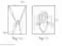 Fig. 11 - POSITIONING DEVICE AND METHOD FOR USE WITH A PATIENT UNDER ANESTHESIA