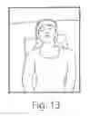 Fig. 13 - POSITIONING DEVICE AND METHOD FOR USE WITH A PATIENT UNDER ANESTHESIA