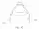 Fig. 16 - POSITIONING DEVICE AND METHOD FOR USE WITH A PATIENT UNDER ANESTHESIA