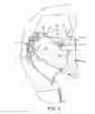 Fig. 06 - CONVERSION MASK