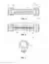 Fig. 05 - Nasal assembly