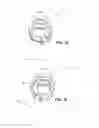 Fig. 11 - Nasal assembly