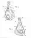 Fig. 18 - Nasal assembly