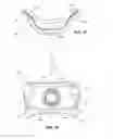 Fig. 22 - Nasal assembly