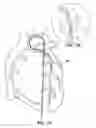 Fig. 08 - GUIDE CATHETER EXTENSION DEVICE AND METHODS OF USE FOR CARDIOLOGY PROCEDURES
