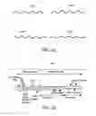 Fig. 15 - Implantable fluid delivery apparatus and implantable electrode
