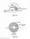Fig. 16 - Implantable fluid delivery apparatus and implantable electrode