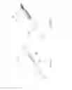 Fig. 10 - Deep brain stimulation lead