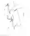 Fig. 11 - Deep brain stimulation lead