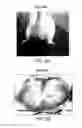 Fig. 04 - Dipole electrical stimulation employing direct current for recovery from spinal cord injury
