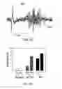 Fig. 10 - Dipole electrical stimulation employing direct current for recovery from spinal cord injury