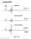 Fig. 29 - Dipole electrical stimulation employing direct current for recovery from spinal cord injury