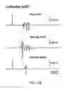 Fig. 30 - Dipole electrical stimulation employing direct current for recovery from spinal cord injury