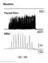 Fig. 33 - Dipole electrical stimulation employing direct current for recovery from spinal cord injury