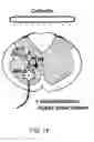 Fig. 35 - Dipole electrical stimulation employing direct current for recovery from spinal cord injury