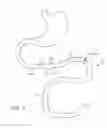 Fig. 02 - Swallowable capsule and method for stimulating incretin production within the intestinal tract