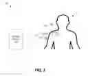 Fig. 02 - THERAPEUTIC STIMULATION SYSTEM