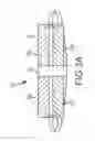 Fig. 04 - Systems, devices and methods for the treatment of neurological disorders and conditions