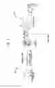 Fig. 02 - Wireless communication in an implantable medical device system