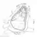 Fig. 02 - Leadless cardiac pacemaker with delivery and/or retrieval features