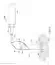 Fig. 04 - Leadless cardiac pacemaker with delivery and/or retrieval features
