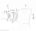Fig. 14 - Leadless cardiac pacemaker with delivery and/or retrieval features