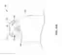 Fig. 23 - Leadless cardiac pacemaker with delivery and/or retrieval features