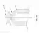 Fig. 25 - Leadless cardiac pacemaker with delivery and/or retrieval features