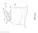 Fig. 26 - Leadless cardiac pacemaker with delivery and/or retrieval features