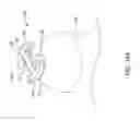 Fig. 29 - Leadless cardiac pacemaker with delivery and/or retrieval features