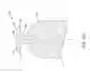 Fig. 31 - Leadless cardiac pacemaker with delivery and/or retrieval features