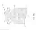 Fig. 37 - Leadless cardiac pacemaker with delivery and/or retrieval features