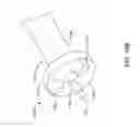 Fig. 48 - Leadless cardiac pacemaker with delivery and/or retrieval features