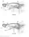 Fig. 09 - Radiotherapy board and couch