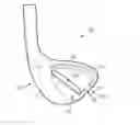 Fig. 01 - Golf club heads with insert and related methods