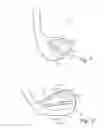 Fig. 02 - Golf club heads with insert and related methods