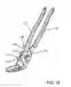 Fig. 17 - Irrigation bolt wrench combination