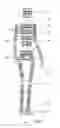 Fig. 03 - Autonomous robot using data captured from a living subject
