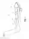 Fig. 02 - Robot arm