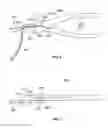 Fig. 04 - Systems and methods for zip-tie cutting