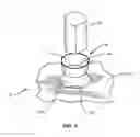 Fig. 04 - Rotary cutting die having inserts for supporting product ejectors